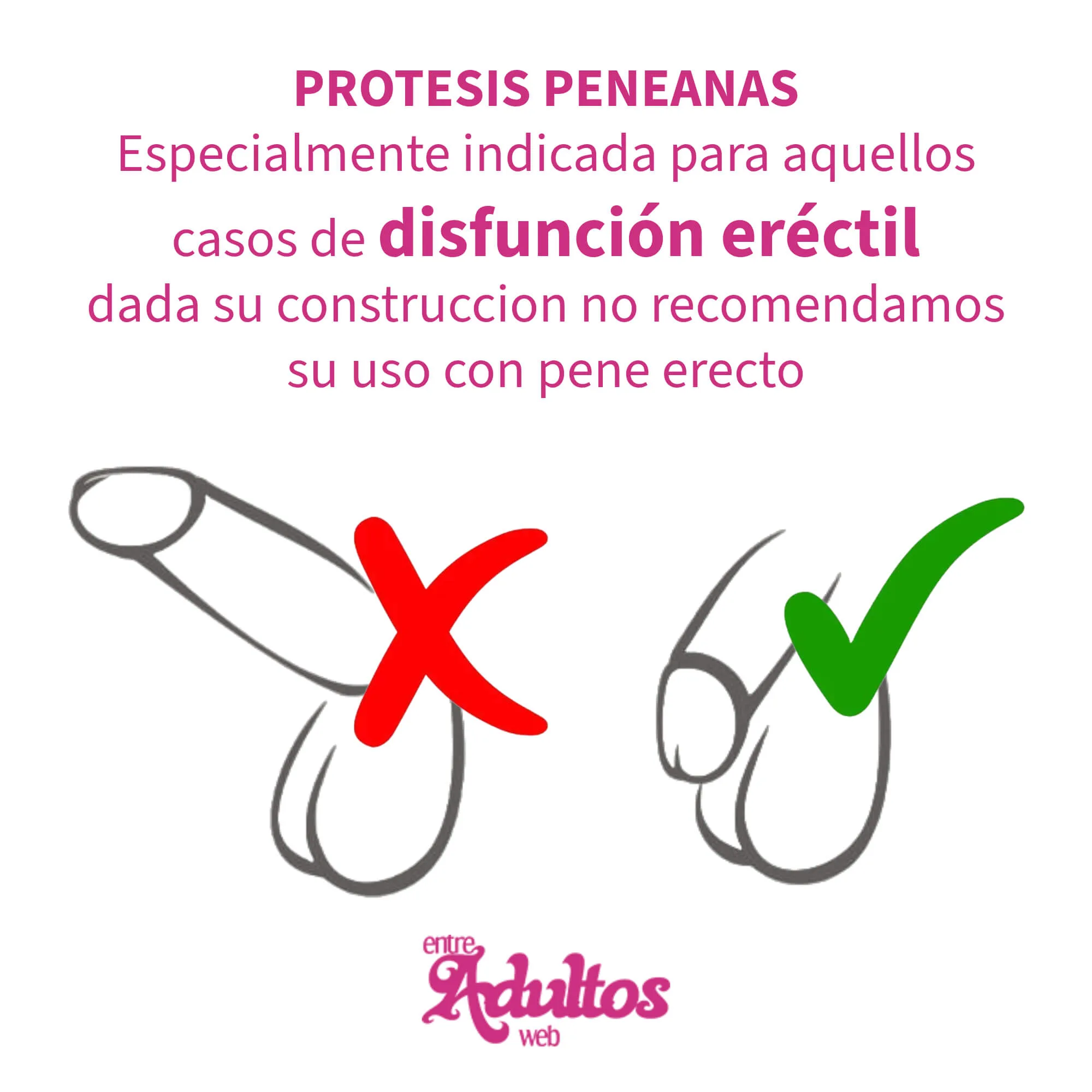 Protesis Peneana Semirigida Pellizcable Mod 3 (17x3cm): imagen 4